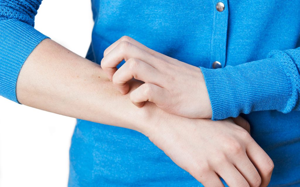Woman scratching her arm because of psoriasis. Hearing loss linked to psoriasis.