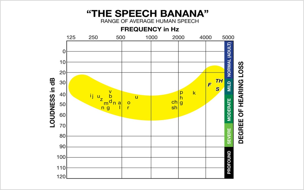 Speech Banana Audiogram Handout Printable